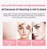 New ultrasonic peeling machine multifunctional facial blackhead peeling instrument into cleansing instrument pore cleaning instrument-Pink